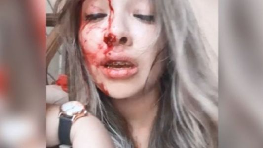 Una joven se grabó luego de ser brutalmente golpeada por su novio