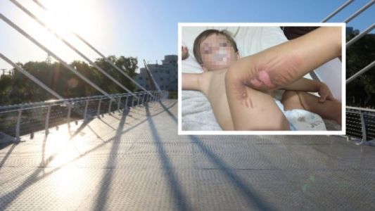 Un niño sufrió quemaduras por tocar el piso del nuevo puente peatonal en Carlos Paz
