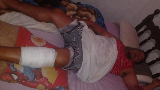 Verano de terror: se rompió un tobogán de agua en Mar del Plata y una pareja sufrió heridas