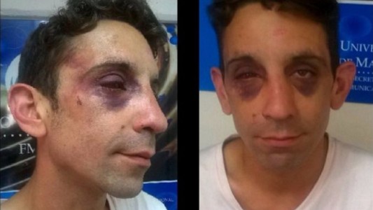 Un joven gay denuncia haber sido salvajemente golpeado por una patota neonazi