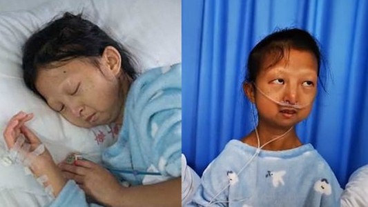 Murió la joven de 24 años que comía solo arroz para poder pagar el tratamiento médico de su hermano