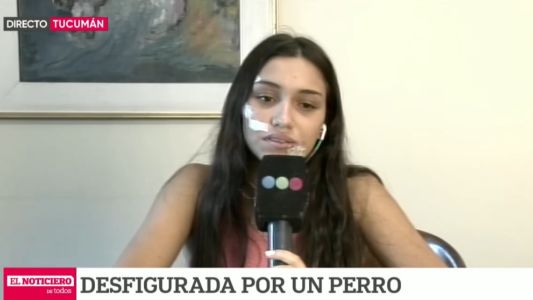 Habló Lara: "es un perrito que nunca había mordido a nadie"