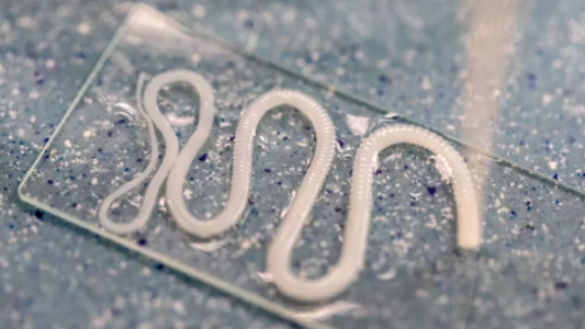 Sufría fuertes dolores de cabeza hasta que le sacaron una lombriz solitaria que tuvo por 10 años