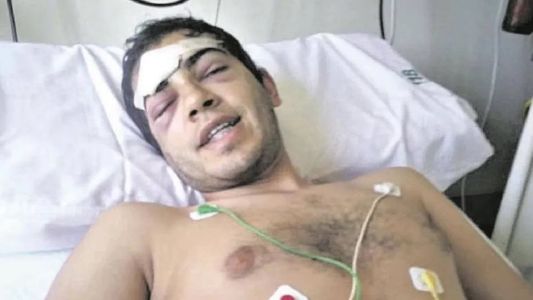 Otra brutal golpiza a la salida de un boliche: está internado con fractura de cráneo