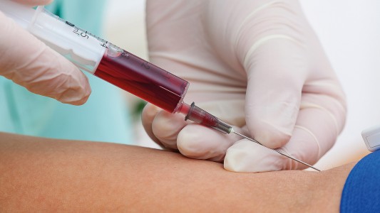 La Justicia avaló la extracción compulsiva de sangre a un acusado de abuso sexual