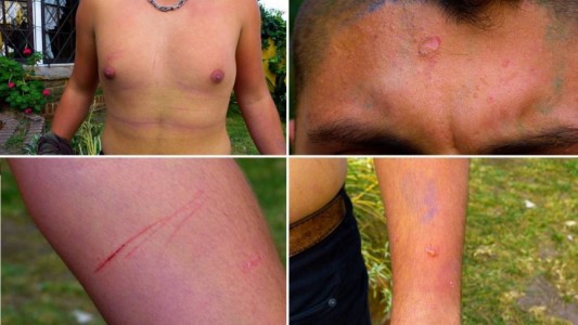 Desvincularán a los tres efectivos de la policía bonaerense que torturaron a un militante LGBT en Miramar