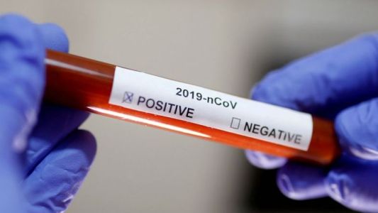 Coronavirus: cómo funcionan los test para detectar un caso positivo