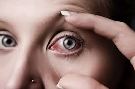Advierten que la conjuntivitis puede ser un síntoma de coronavirus