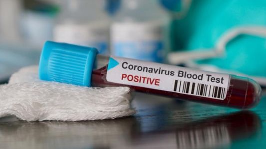 Investigadores piden donación de sangre a quienes hayan tenido coronavirus Covid-19