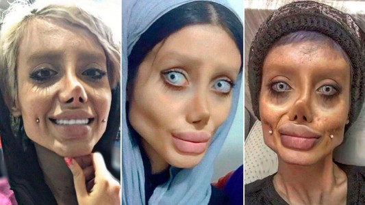 El drama de la Angelina Jolie iraní: tiene coronavirus en la cárcel y está grave