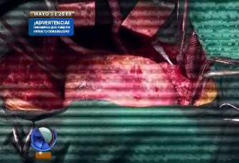 "Con el corazón en la mano"