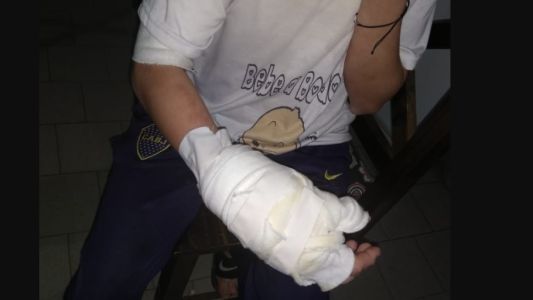 Prendíó fuego a su pareja cuando tenía en brazos a la beba de ambos