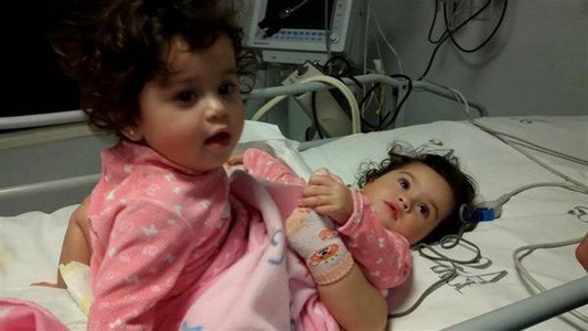 Parte médico de la siamesa que sobrevivió: "despierta y compensada"