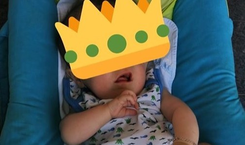 Rodrigo, el "bebé sin rostro", cumplió 7 meses: le habían pronosticado pocas horas de vida