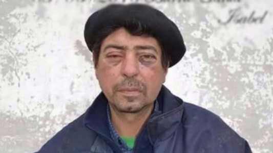 Le pidió a unos policías que dejen de mirar el celular y recibió una brutal golpiza