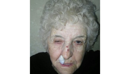 Al denunciar un robo, en la comisaría le pidieron un examen ginecológico y anal