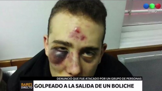 Brutal golpiza a un joven a la salida de un boliche en Palermo