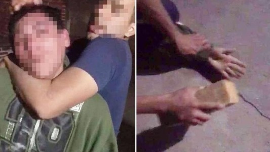 Atraparon un hombre robando en una casa y le quebraron los dedos con un ladrillo