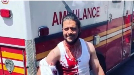 Video impactante: un hombre camina con un cuchillo clavado en la cabeza luego de ser atacado