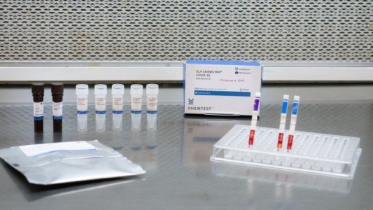 Hospitales públicos bonaerenses recibieron los test de diagnóstico rápido del COVID-19