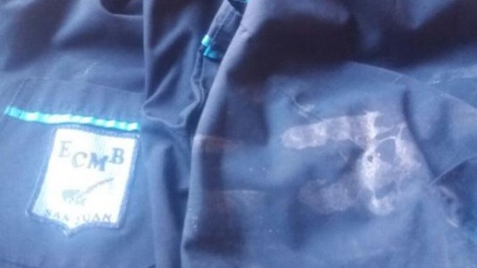 Niño víctima de bullying sufrió traumatismo de cráneo al ser golpeado por compañeros de escuela