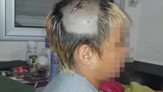 Tres policías fueron detenidos por golpear ferozmente a un chico de 10 años