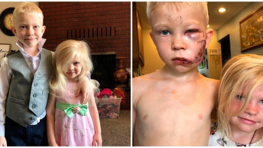 Pequeño gran héroe: un chico de 6 años salvó a su hermana del ataque de un perro