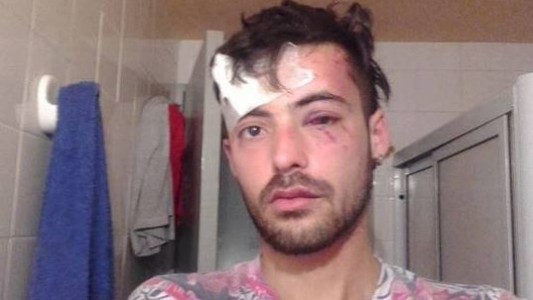 Lo golpearon por ser homosexual