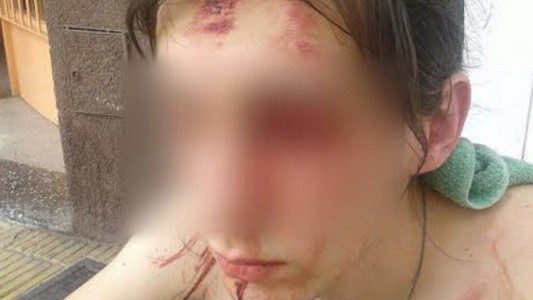 Un joven fue apuñalado al intentar defender a su novia