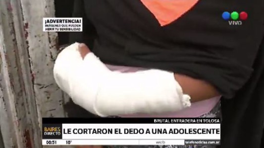 Le cortaron el dedo a una adolescente