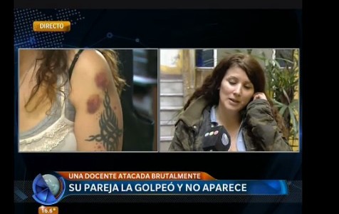 Su pareja la golpeó y está prófugo: a la víctima no le dan el botón antipánico