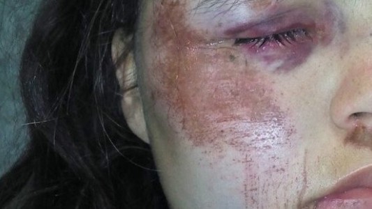 Denuncia que su ex la atacó junto a otras tres personas a la salida de un boliche