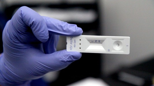 Lanzan manual con estrategias de tests rápidos de VIH y sífilis