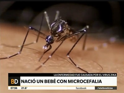 Nació en Córdoba un bebé con microcefalia infectado por el virus del zika