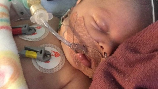 El bebé que tuvo tres paros cardíacos por culpa de una gota de leche