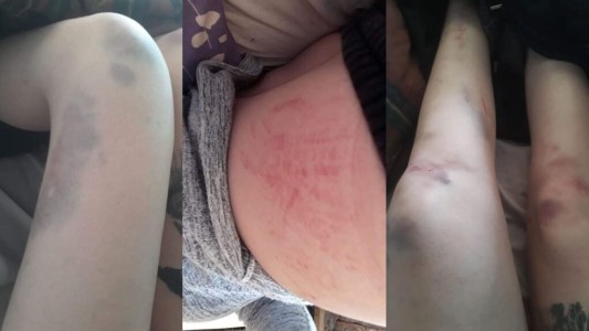 Una mujer denunció que dos policías golpearon a su hija