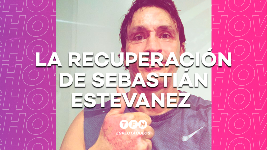 La recuperación de Sebastián Estevanez tras las quemaduras