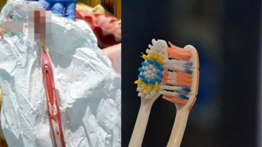 Se tragó el cepillo de dientes y debieron extraérselo del estómago