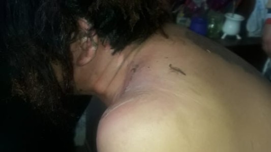 Moreno: roban un almacén y prenden fuego a la dueña del comercio