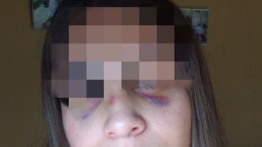 Un policía de Pico Truncado golpeó a su novia y le causó una triple fractura nasal