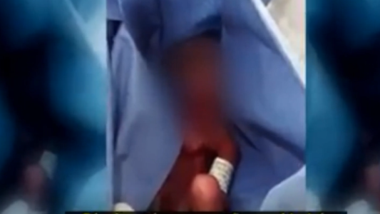 México: Dieron por muerto a un bebé recién nacido y su papá descubrió que estaba vivo