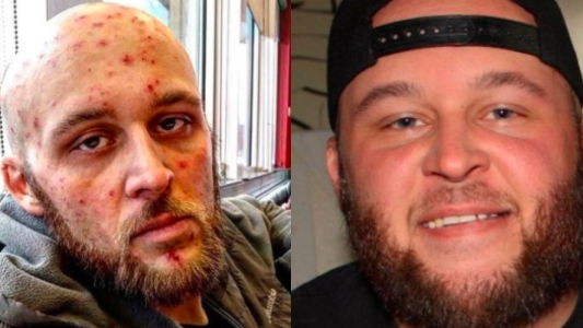 Se recuperó de las drogas, mostró los cambios y se volvió viral