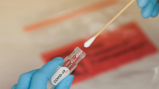 Se hicieron pasar por enfermeros hisopadores y asaltaron a un jubilada en el barrio de Monserrat