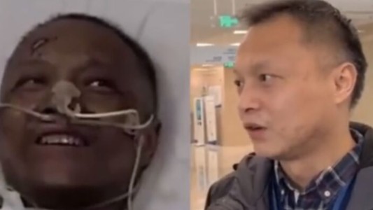 Reapareció en público el médico chino cuya piel se oscureció durante el tratamiento contra el covid-19