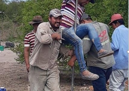 "Proyecto Agustina 2020": una nena quemada inspira a encontrar agua para 100 familias en El Impenetrable