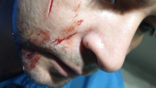 Atacaron a cuchilladas a un colectivero y los choferes reclaman las cabinas blindadas