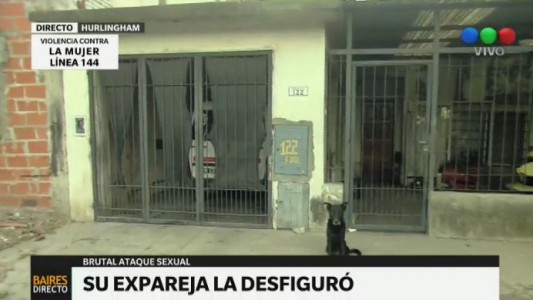 Su ex pareja la desfiguró