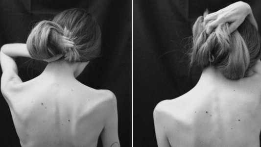 La criticaron y se burlaron en redes sociales por su delgadez: contó que tiene cáncer