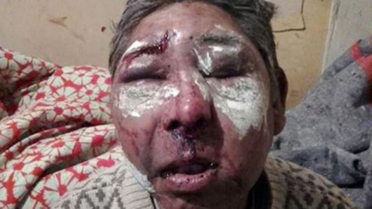 Impactante: lo desfiguraron para robarle un termo, un candado y 60 pesos