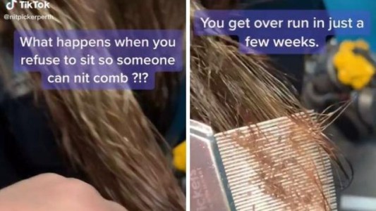 Video de terror: le pasó el peine fino a su hijo y lo sacó repleto de piojos